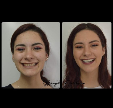 Slider image (7) Centro Odontologico Carrera